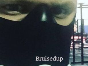 Bruisedup
