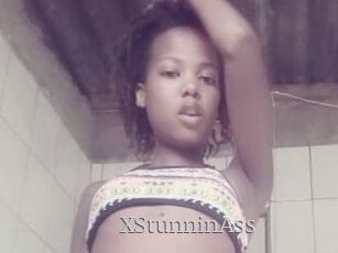 XStunninAss